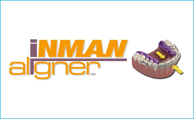Click here for Inman Aligner