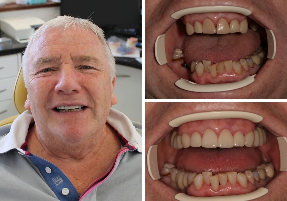 Transforming Your Smile